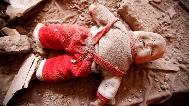 1400 کودک در جنگ یمن کشته شدهاند