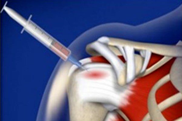 سلولهای بنیادی آسیبهای نخاعی را بازسازی میکنند