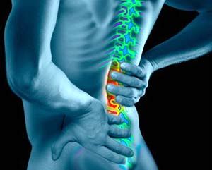 کمتر از 10 درصد کمردردها با جراحی درمان میشود/ شایعترین علت جراحیهای ستون فقرات