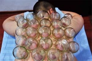 بادکش؛ جدیدترین درمان ورزشکاران المپیکی + تصاویر