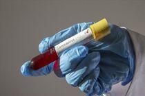 Zionist Regime Health Minister tested positive for coronavirus