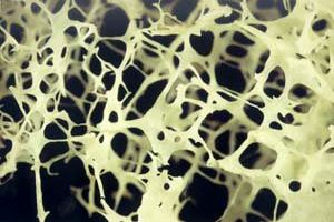 ورزش چربی استخوان را از بین می‌برد