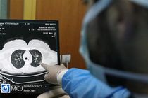 جدیدترین آمار کرونا در کشور تا ظهر ۱۴ تیر ۹۹/  ۱۸ استان در وضعیت قرمز و هشدار