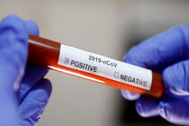 افغانستان نخستین مورد از ابتلا به ویروس کرونا را تایید کرد