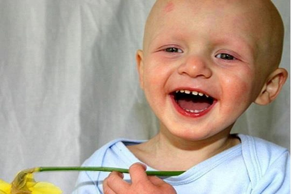 سرطان کوکان