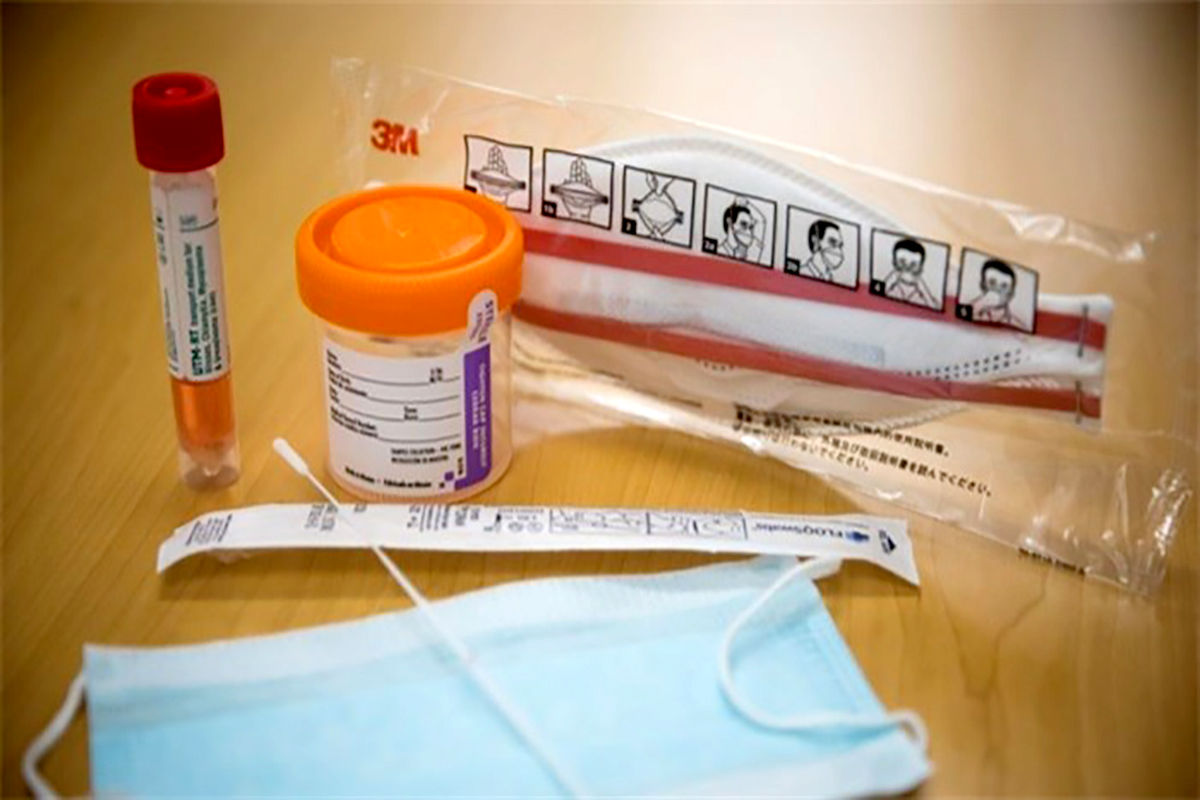  تست سریع کرونا