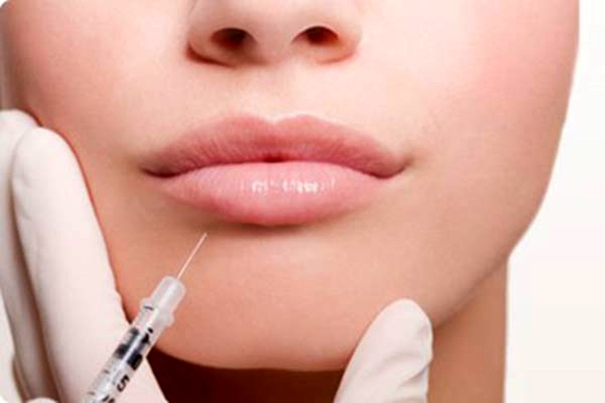 ترزیق ژل لب