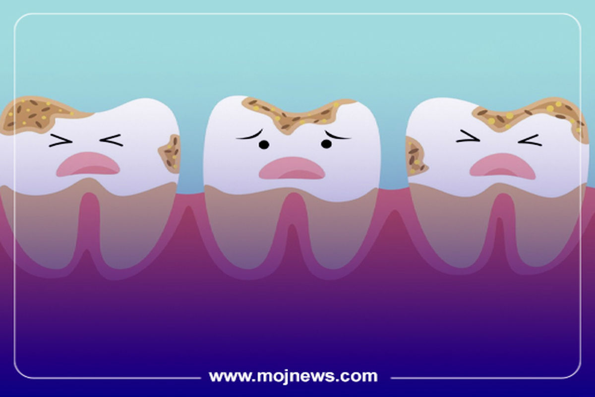 کاور دندان ها موج