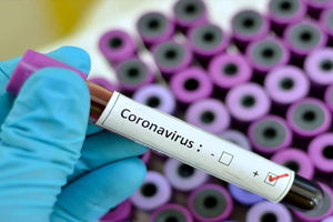 روند افزایشی شیوع کرونا /ثبت 33 مورد جدید کووید 19 در هرمزگان