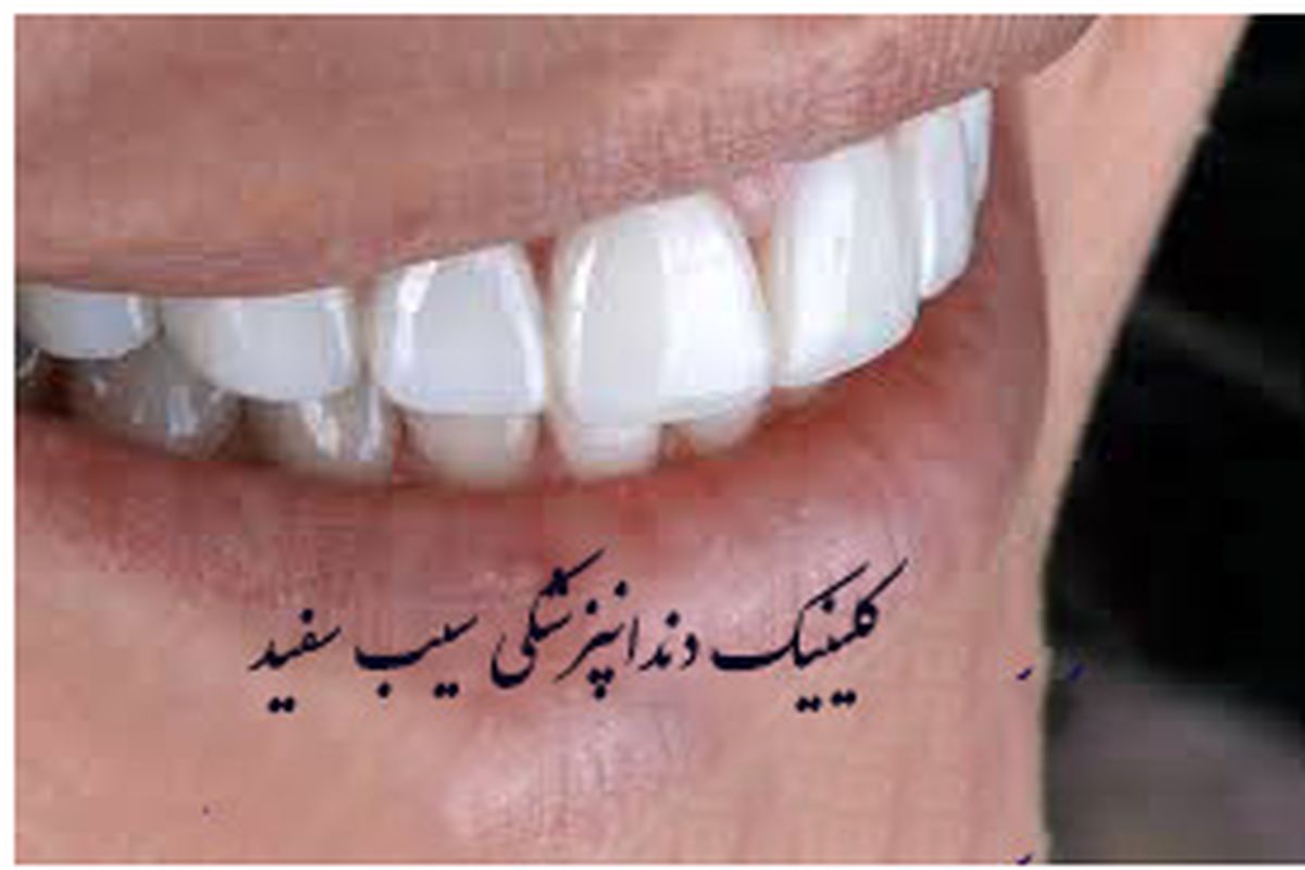 کلینیک دندان پزشکی سیب سفید.