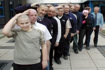 چرا مردان کچل می شوند