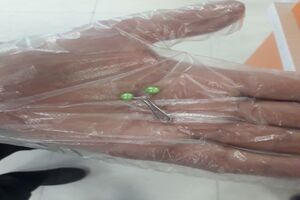 اورژانس قم جان کودک یک ساله را نجات داد