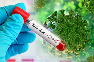 شناسایی 720 ابتلای جدید به ویروس کرونا در منطقه کاشان/ یک فوتی