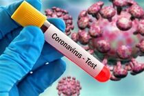 48 ابتلای جدید به ویروس کرونا در منطقه کاشان / تعداد کل بستری ها 444 بیمار 