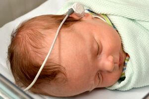 عمل کاشت حلزون گوش حدود دو هزار کم شنوا در خراسان رضوی 