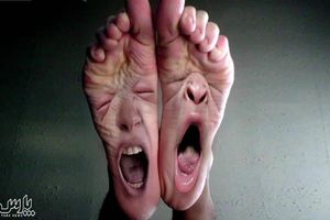 ضعف پا یا بیقراری پا درمان دارد؟ / اگر شما هم به این مشکل مبتلا هستید بخوانید