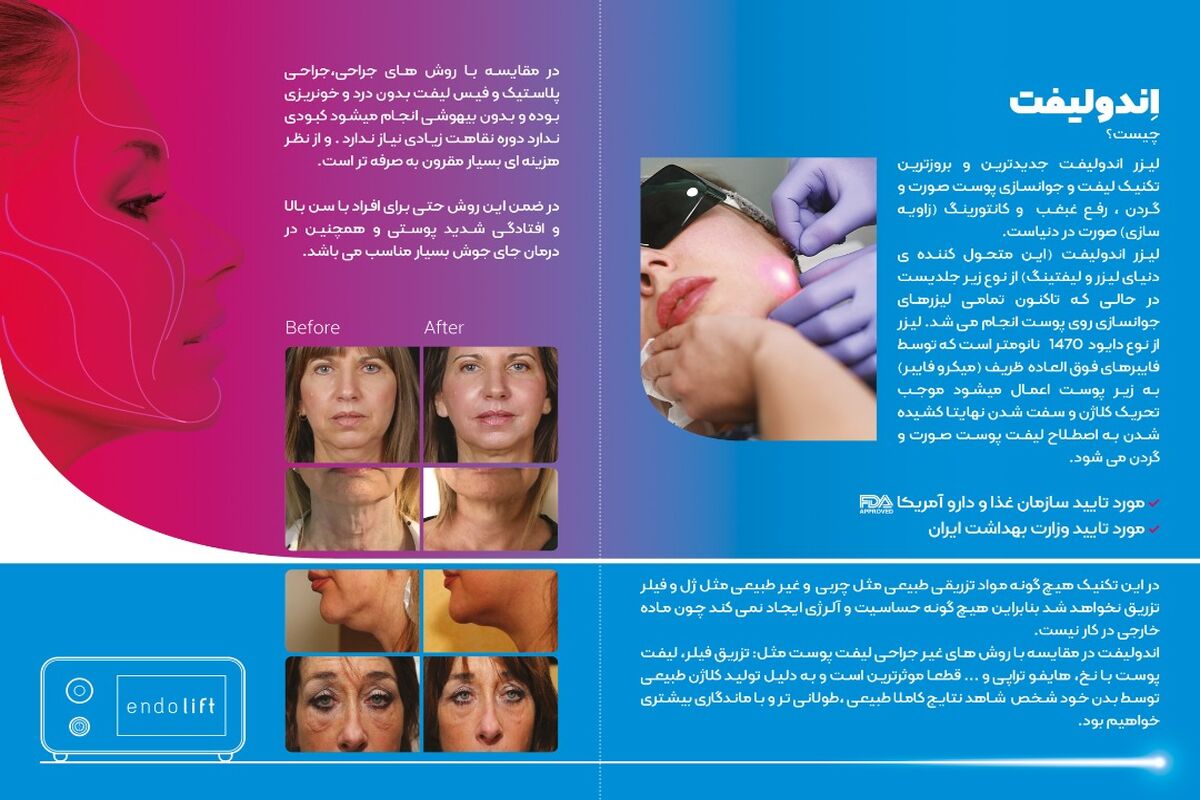 شرکت آریا لیزر