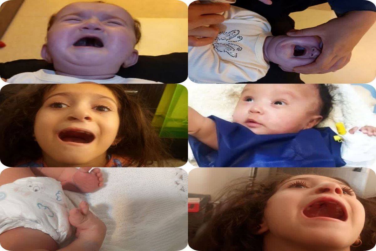 ناهنجاری مادرزادی