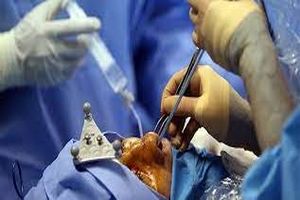 سه زن جوان در کلینیک های جراحی زیبایی پایتخت جان خود را از دست دادند