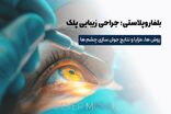 بلفاروپلاستی چیست؟ راهنمای کامل جراحی پلک و انتخاب بهترین دکتر بلفاروپلاستی