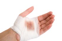 جراحت ها را چگونه درمان کنیم؟