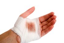 جراحت ها را چگونه درمان کنیم؟