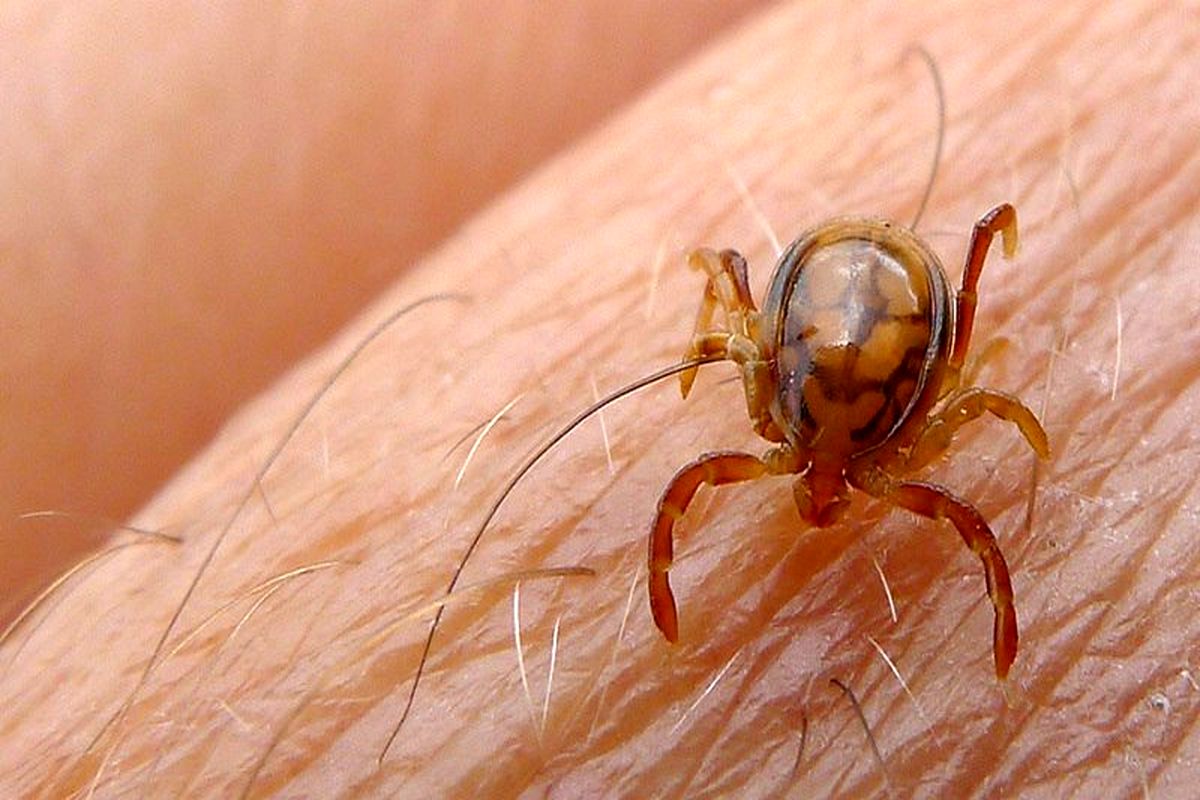 بیماری تب کریمه کنگو 