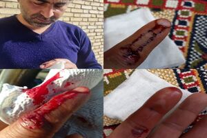 مصدوم شدن کارشناس واحد بهداشت شبکه دامپزشکی شهرستان فلاورجان حین انجام واکسیناسیون هاری
