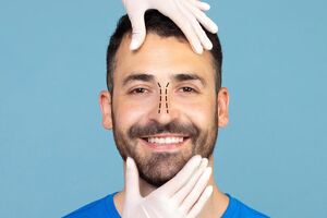راهنمای کامل عمل بینی ترمیمی؛ هزینه، مزایا و معایب