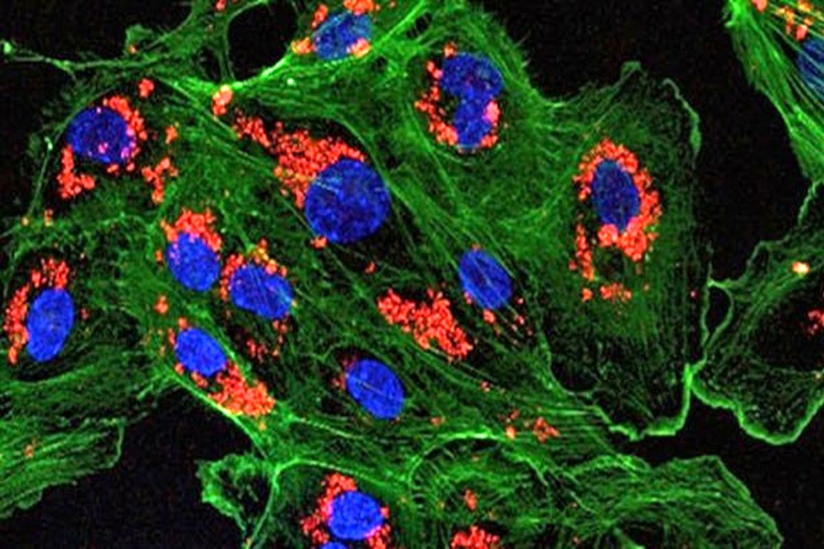 فناوری اندام پیوندی