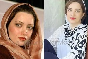 بهنوش طباطبایی با 100 میلیون دگرگون شد / چهار عمل زیبایی که بهنوش طباطبایی را جوان کرد + عکس