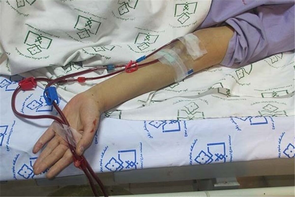 دیالیز