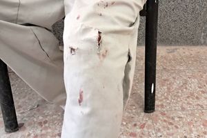 تکنسین دامپزشکی اهواز بر اثر حمله سگ‌های نگهبان حین واکسیناسیون دام‌ها مصدوم شد