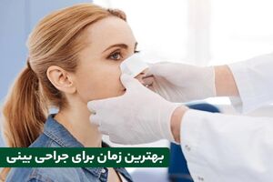 بهترین سن و زمان برای انجام جراحی بینی چه زمانی است؟