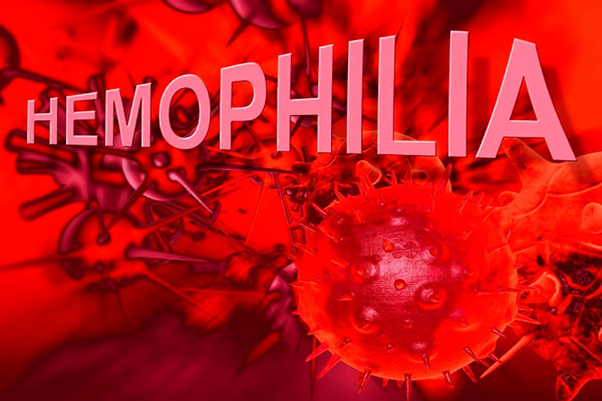 بیماران هموفیلی کرمانشاه