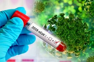 احتمال آلودگی ۱۵ میلیون تن به کرونا در کشور تا کنون / تاثیر بازگشایی‌ها در افزایش موارد جدید کرونا