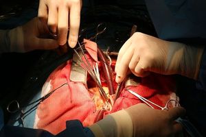 کنگره بین المللی جراحی ها و تکنیک های کم تهاجمی در تهران برگزار می شود