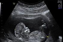 توزیع کیت‌های استاندارد غربالگری محدودیتی ندارد