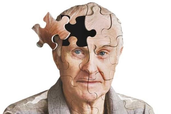 هوش مصنوعی فهم مکانیسم مولکولی آلزایمر و پارکینسون را ممکن می‌کند