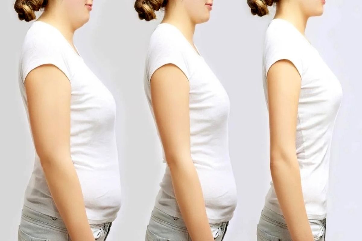 جراح لیپوماتیک