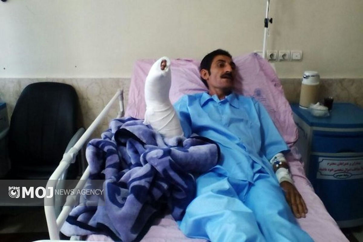 پیوند ساعد در بیمارستان شهدای عشایر خرم‌آباد