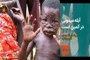 موارد مشکوک ابتلا به آبله میمون در مراکش هم شناسایی شد