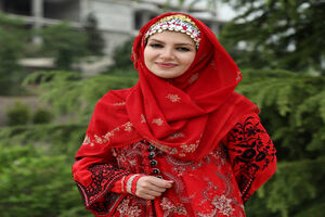 تغییر چهره عجیب ملیکا زارعی / خاله شادونه رو دیگه کسی نمیشناسه