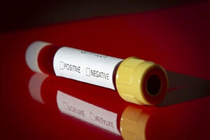 One coronavirus patient can infect up to 400 persons
