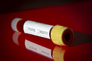 One coronavirus patient can infect up to 400 persons