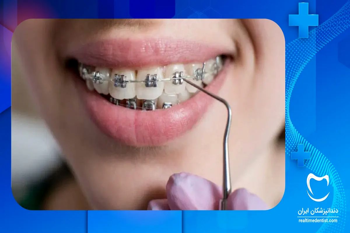 بهترین متخصص ارتودنسی