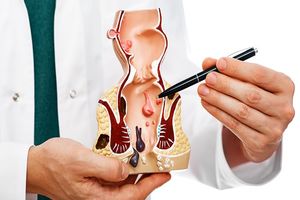 درمان بواسیر در 10 دقیقه!