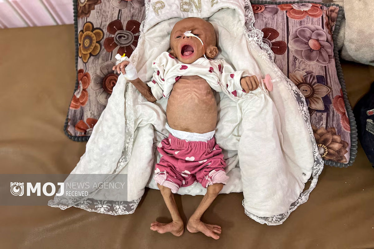 گرسنگی فاجعه بار در غزه