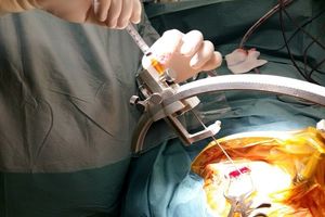 ایجاد کنسرسیوم دانشگاهی در حوزه علوم شناختی