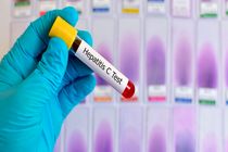 انجام بیش از ۱۰ هزار تست تشخیص سریع هپاتیت در فارس 